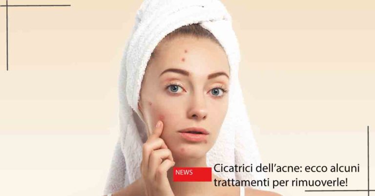 Cicatrici dell'acne | Dott. Massimo Luni
