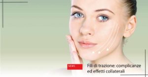 fili di trazione complicanze