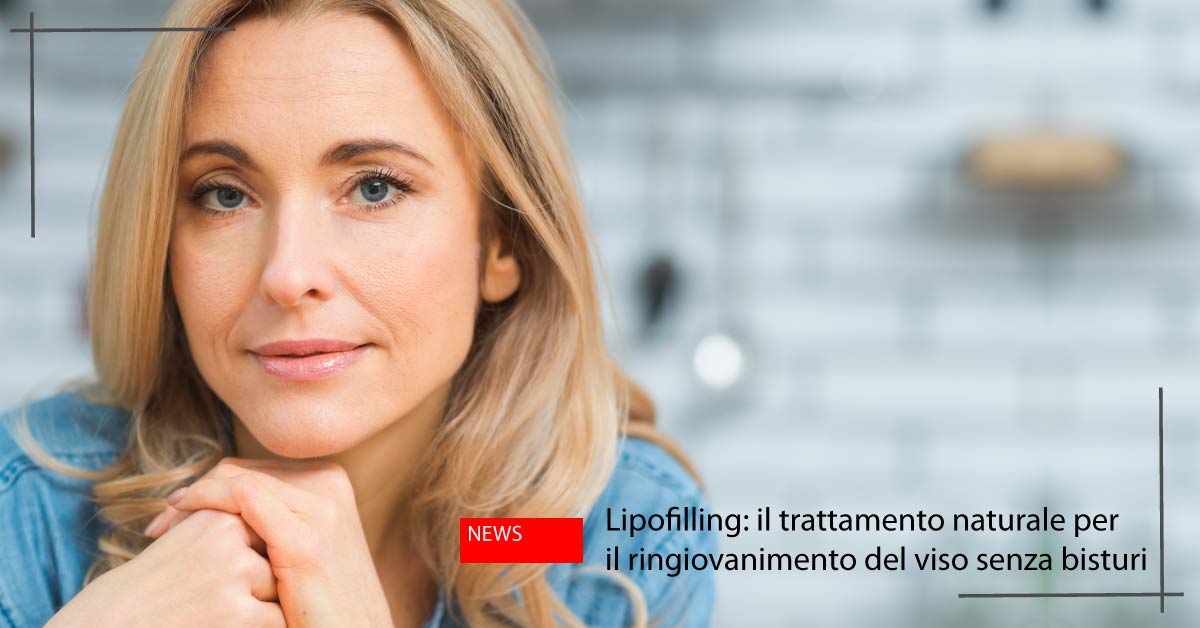 Ringiovanimento del viso senza bisturi - Lipolifting a Orbassano
