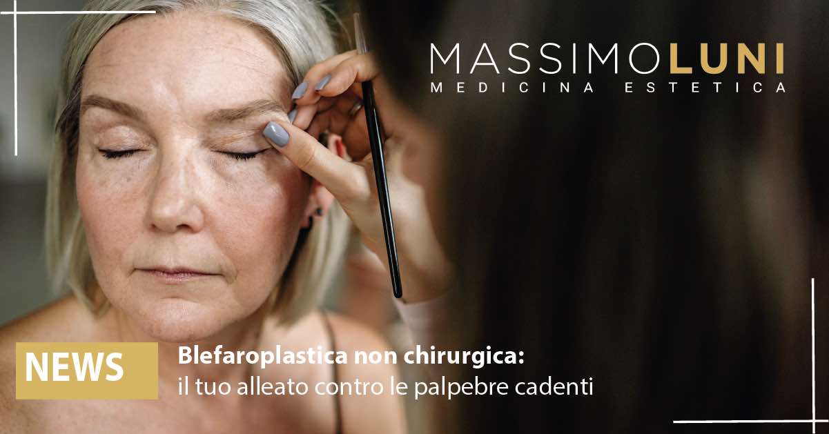 Befaroplastica non chirurgica Orbassano palpebre cadenti 3