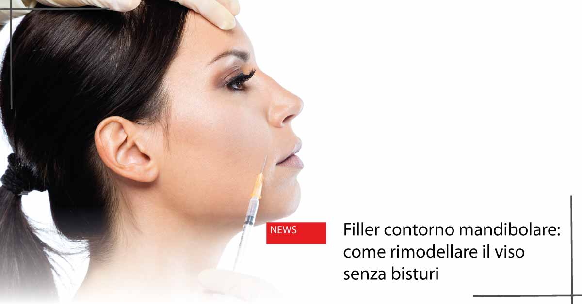 Filler contorno mandibolare Orbassano 2